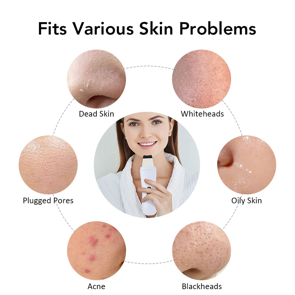 Épurateur de Peau Ultrasonique – Épurateur de peau à ultrasons 4 modes